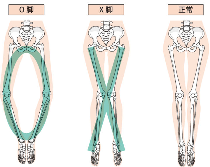 月島でO脚改善！パーソナルジムenbodyの魅力の画像